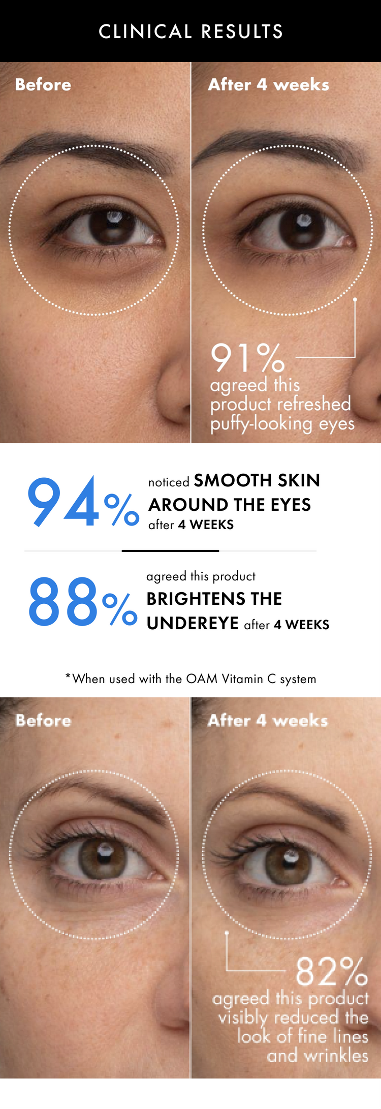 Vitamin C Eye Revitalizer